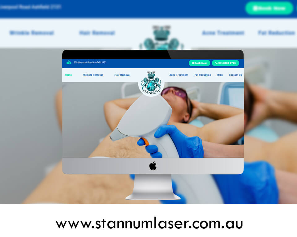 Stannum Laser